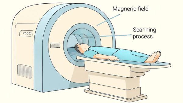 MRI scan procedure